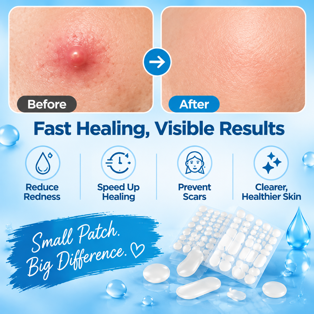 Hydrocolloid Acne Patch Variety Pack